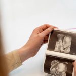 What Do We Know About Foetal Alcohol Spectrum Syndrome?